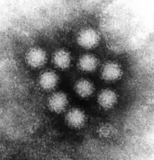 Noro-Virus unterm Mikroskop (Bild: EPA)