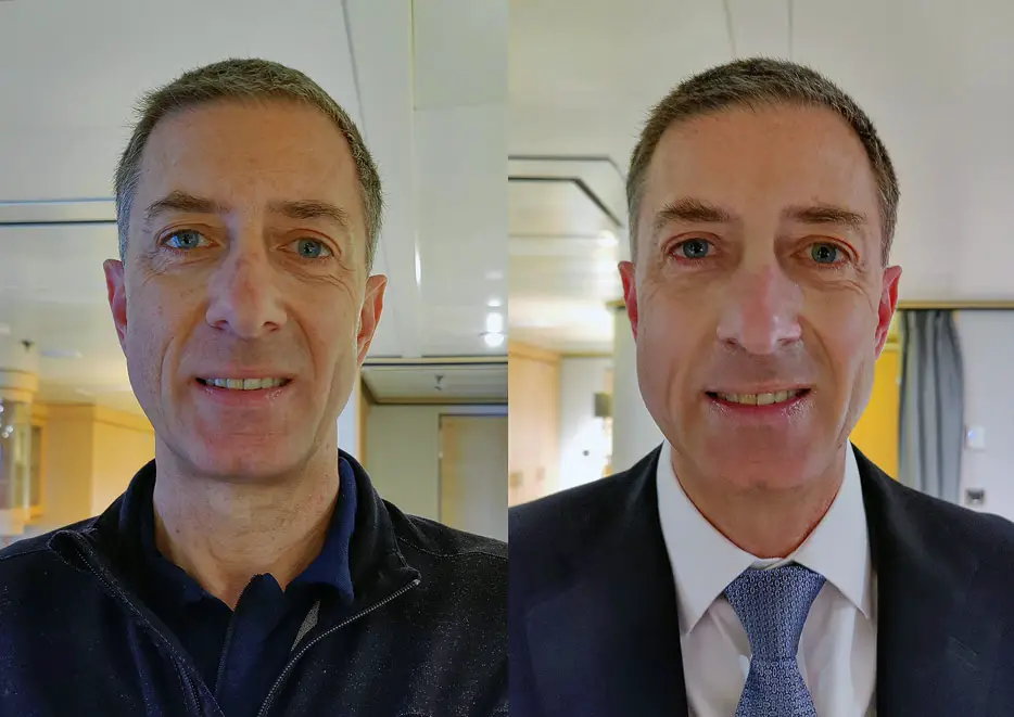 Vorher-Nachher-Foto: Men's Rejuvenating Facial im Spa